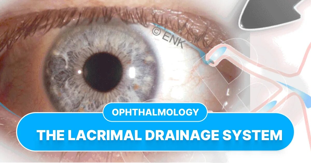 Aplicare: Direcția canalului lacrimal spre tâmplă