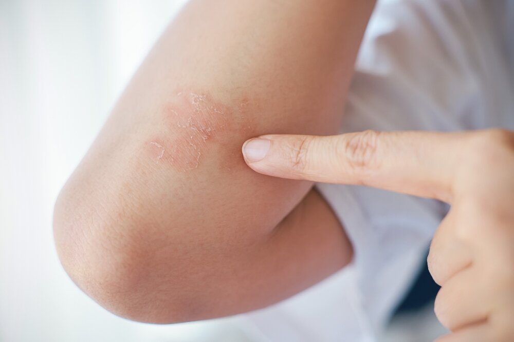 Aplicare direct pe stick sau pe piele