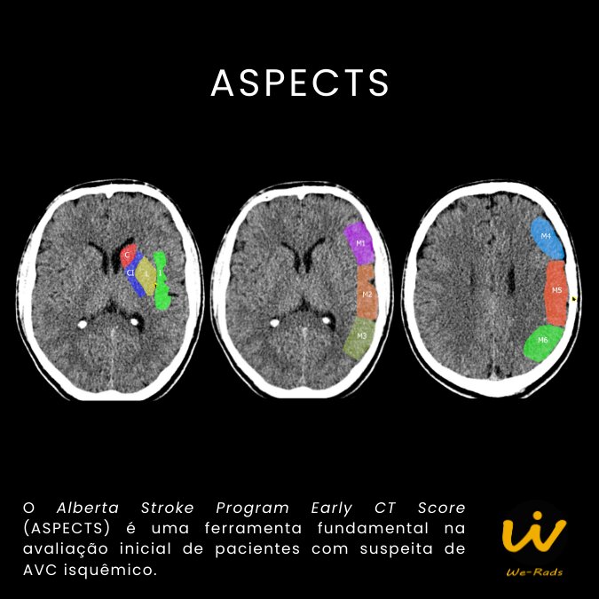 Aspect hibernal
