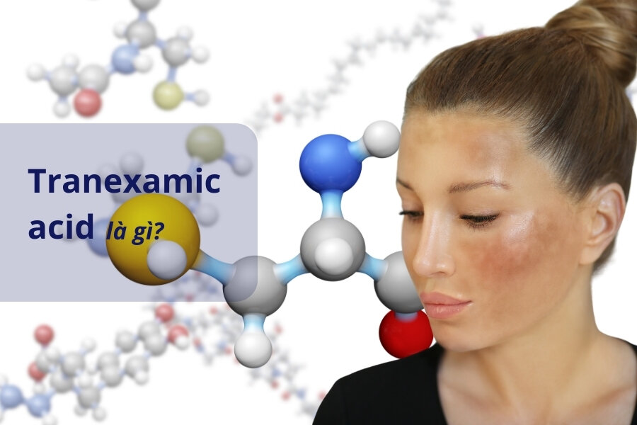 Beneficiile acidului tranexamic