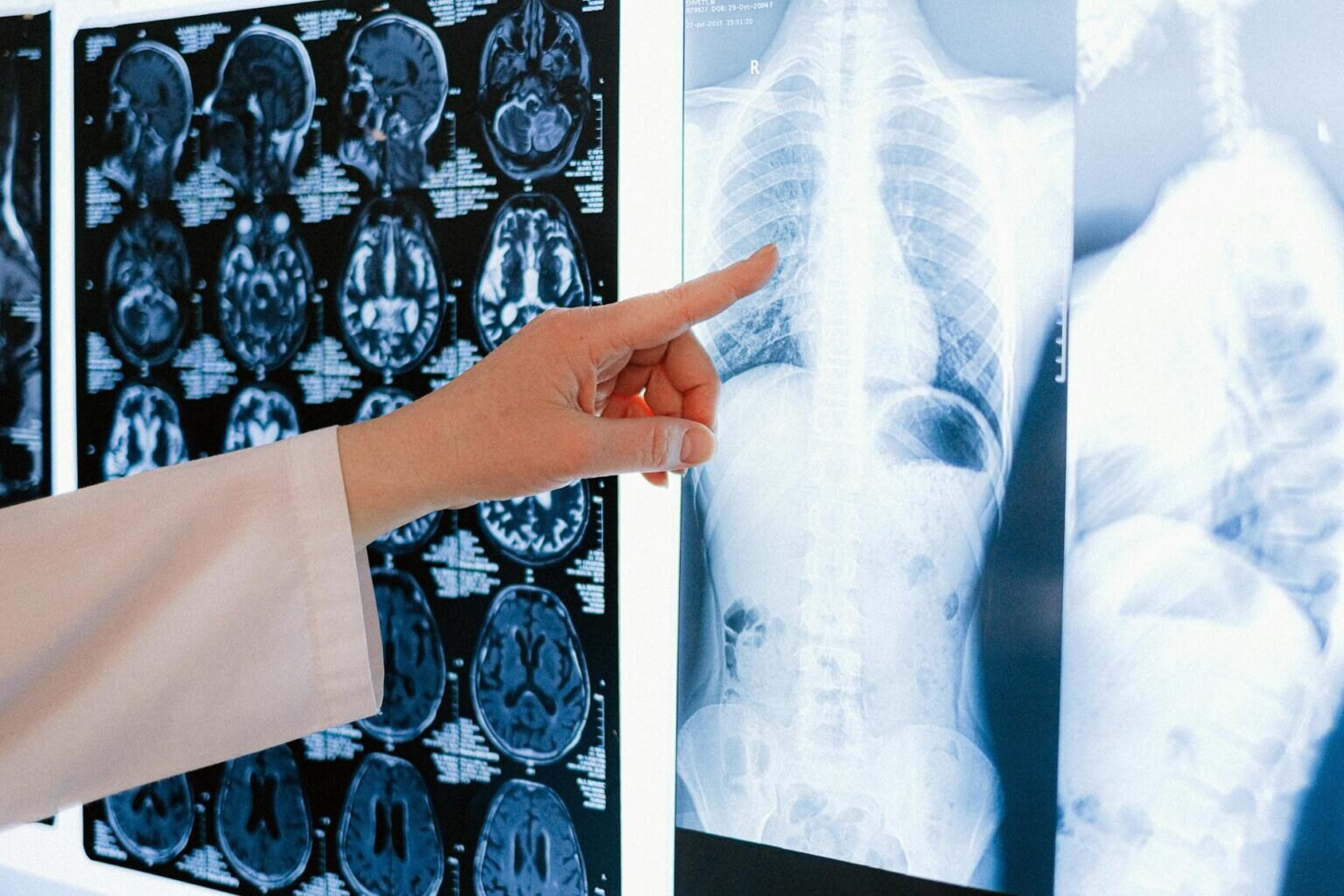 Beneficiile coenzimei Q10 pentru piele