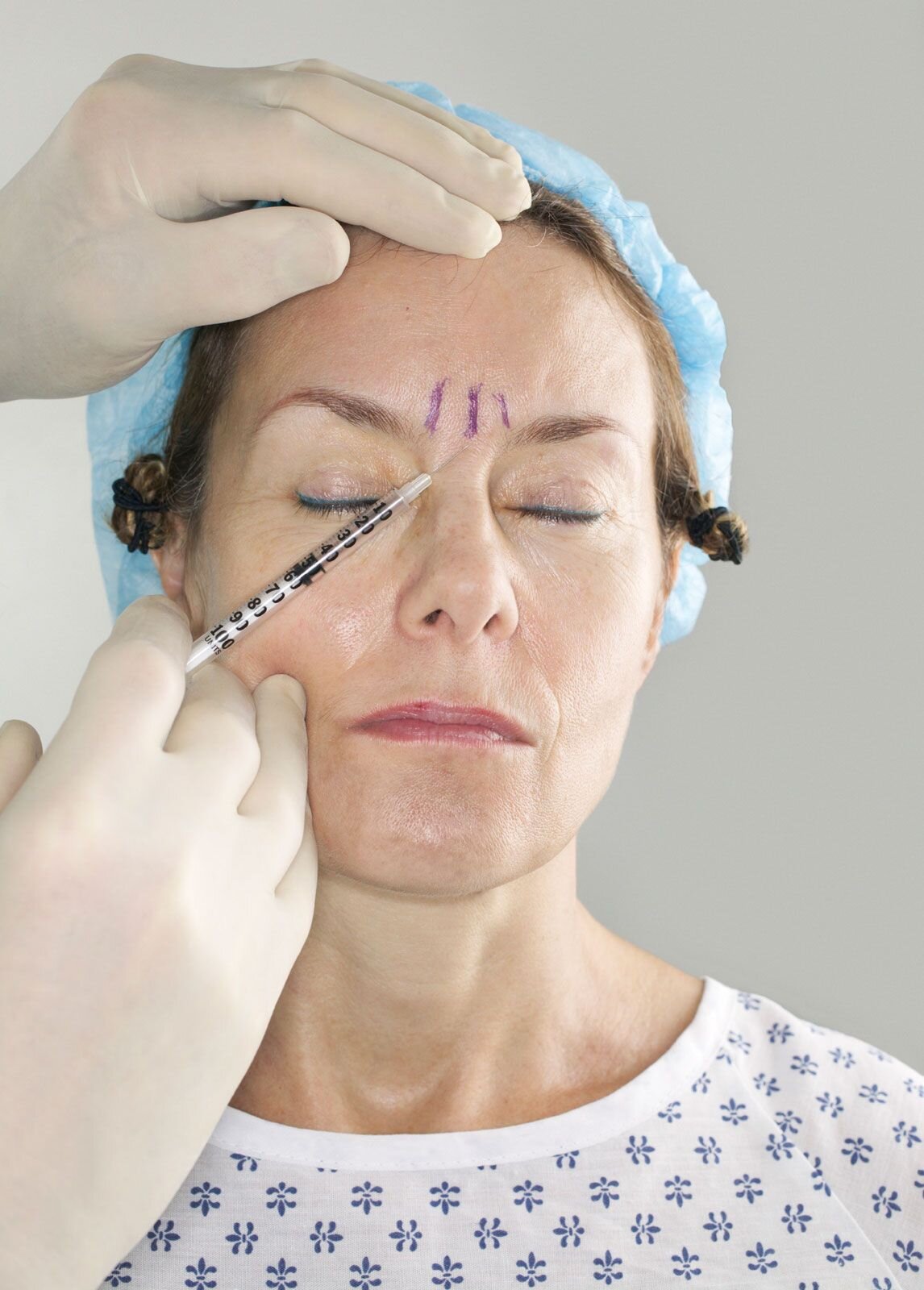 Botox