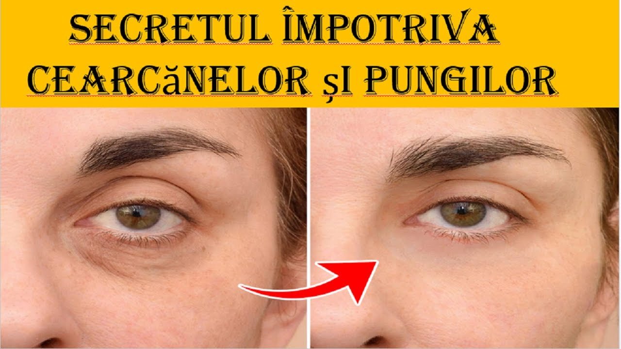 Camuflarea cearcănelor, coșurilor și petelor