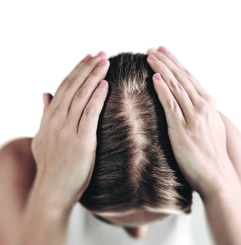 Cauze diverse: stres, sezonier, îmbătrânire, modificări hormonale, alopecie
