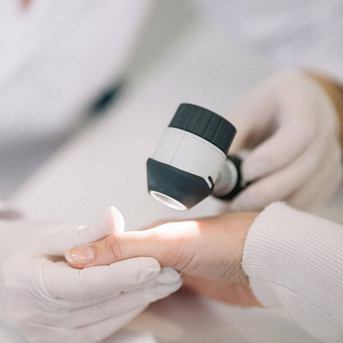 Consultarea dermatologului