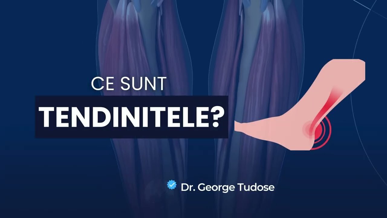 Descrierea tendinței