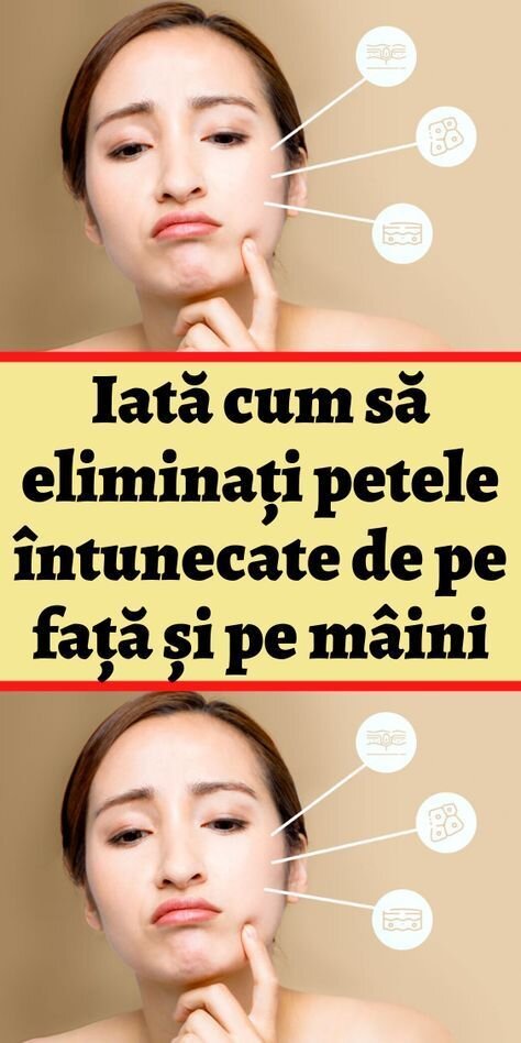 Estoampă petele, uniformizează tenul