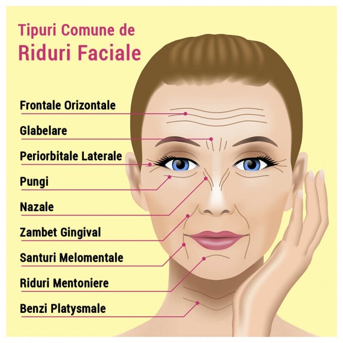 Factori care influențează apariția ridurilor