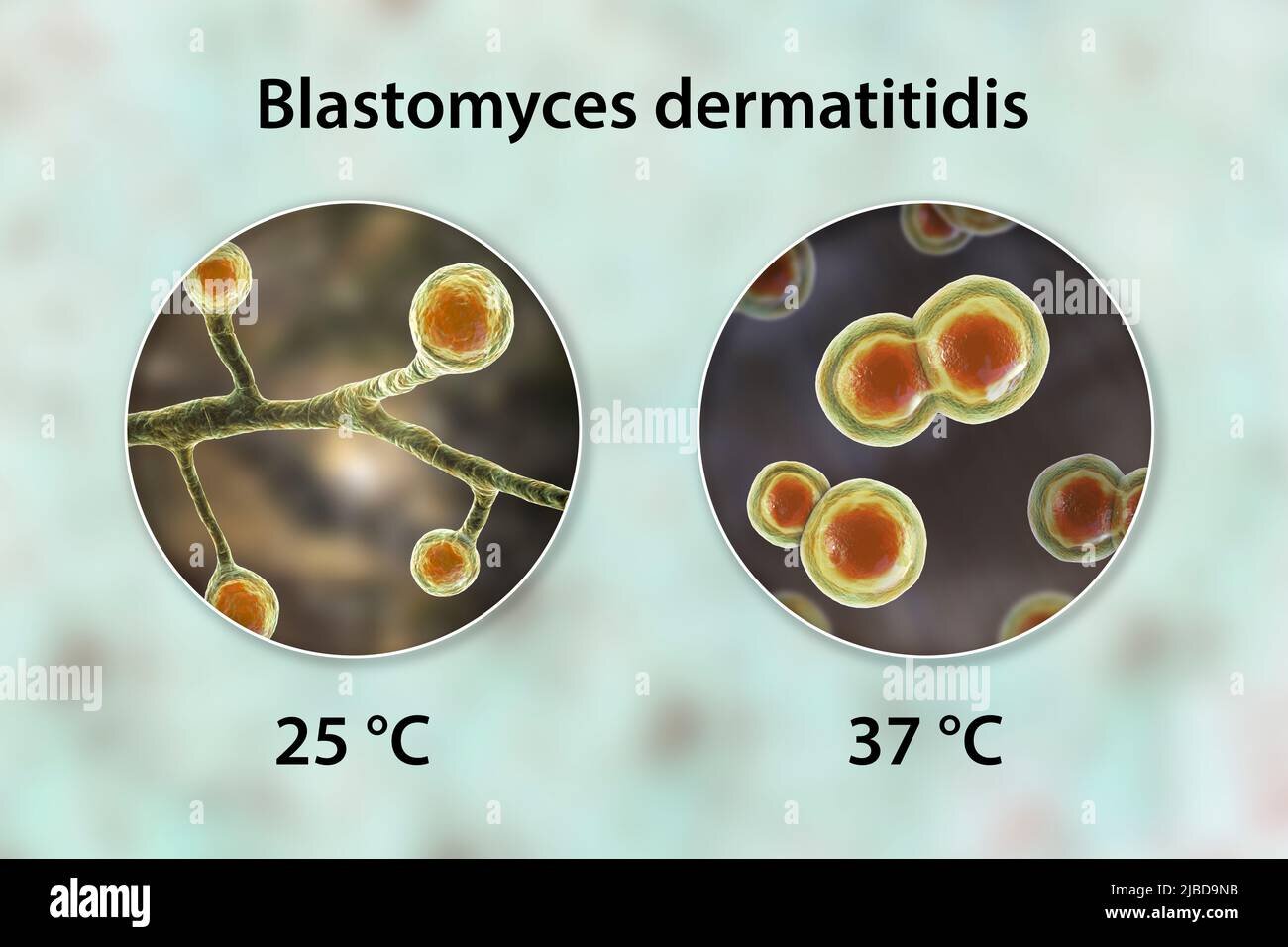 Forma cutanată a blastomicozei