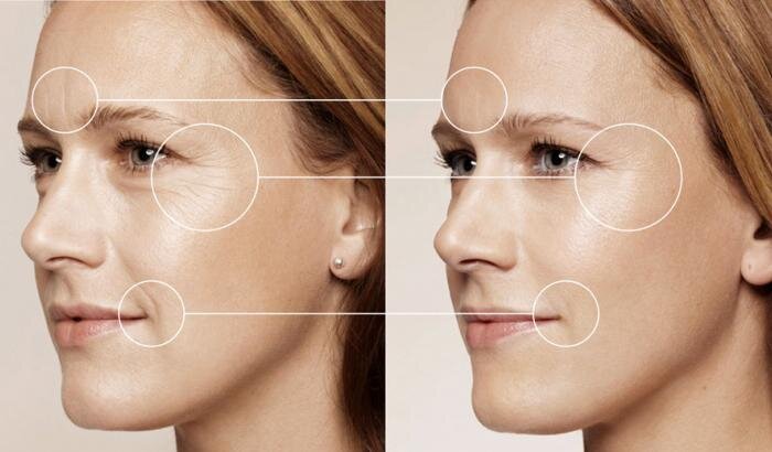 Formula cu acid hialuronic pentru umiditate