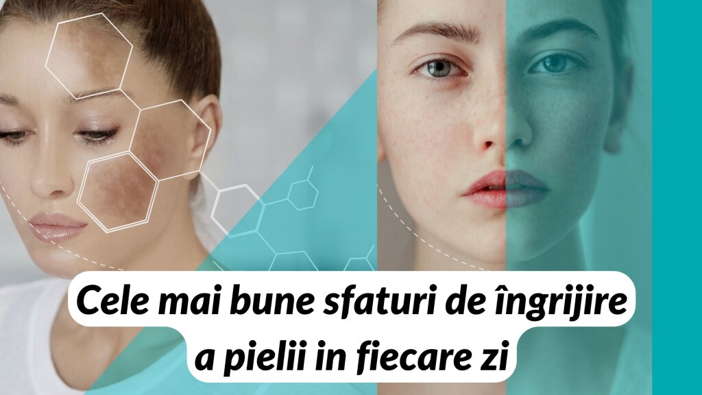 Îngrijire și întreținere