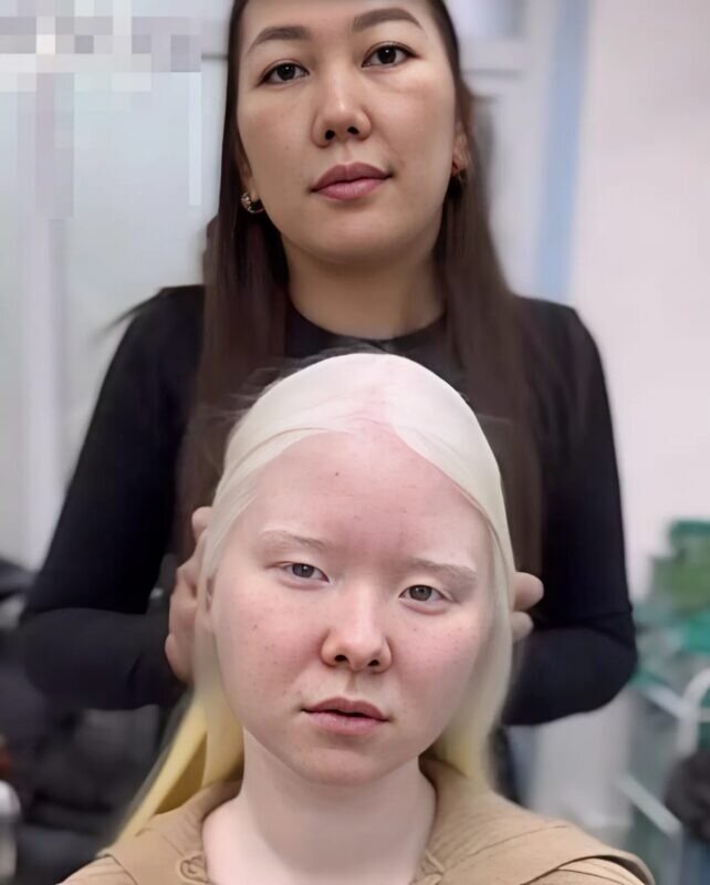 Niacinamida: inhibă transferul de melanină