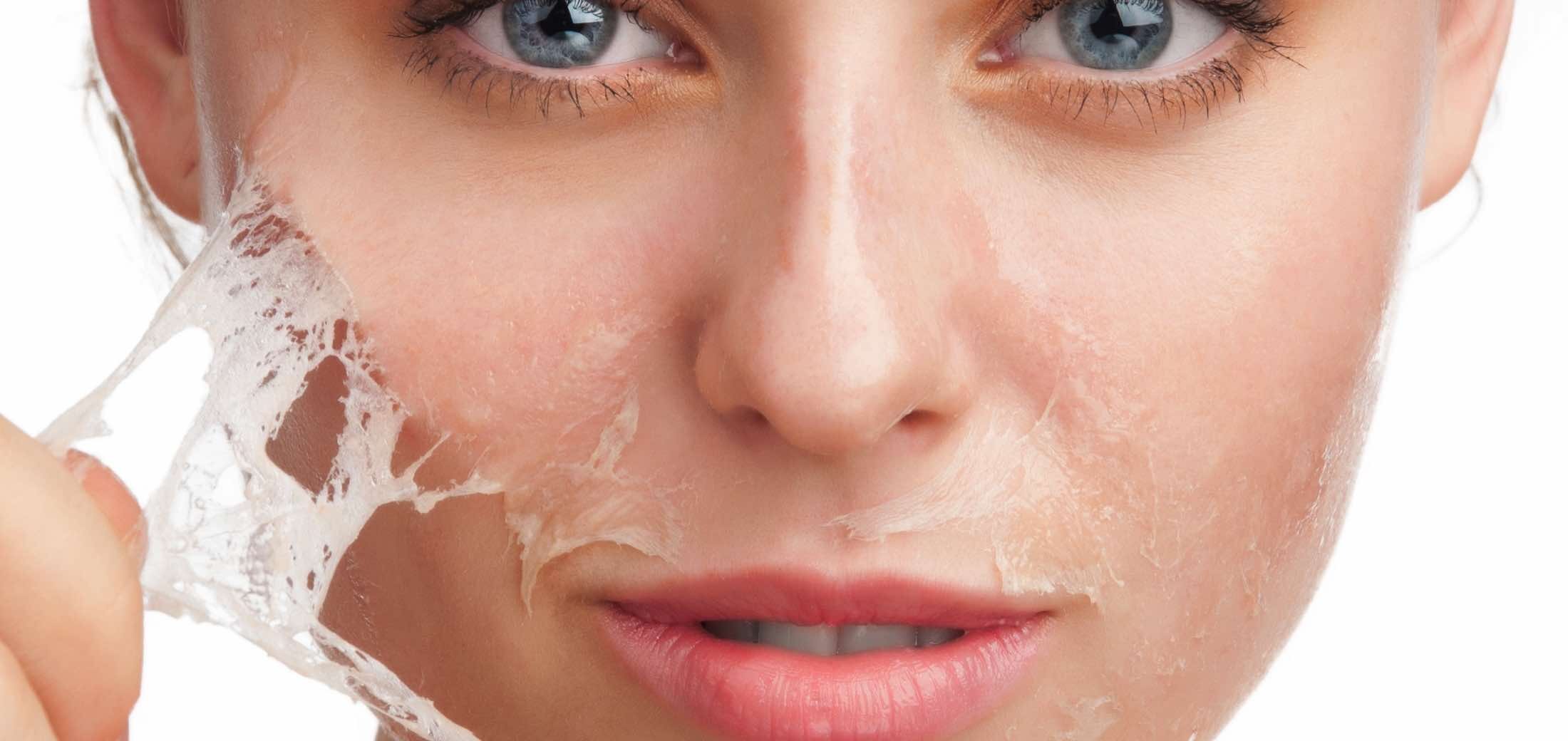 Peeling chimic cu alfa-hidroxiacizi și beta-hidroxiacizi