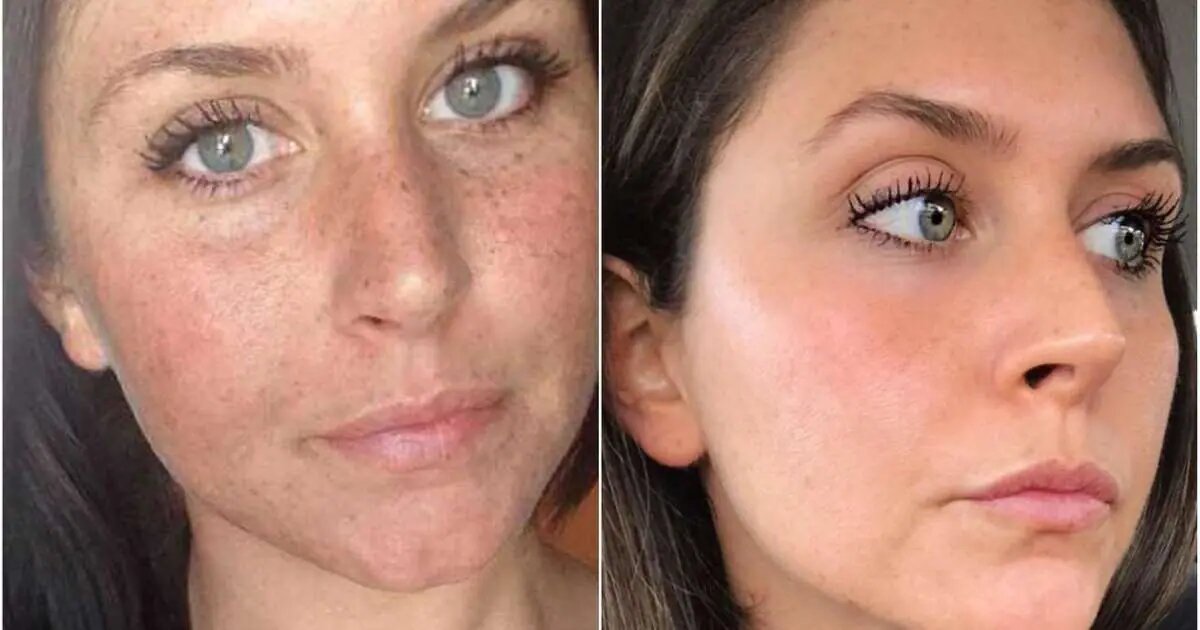 Piele luminoasă și fără imperfecțiuni