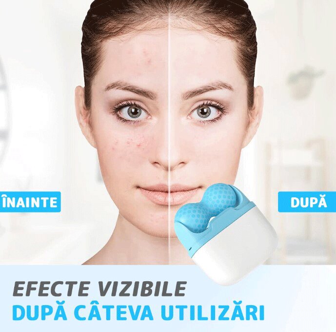 Prevenirea ridurilor