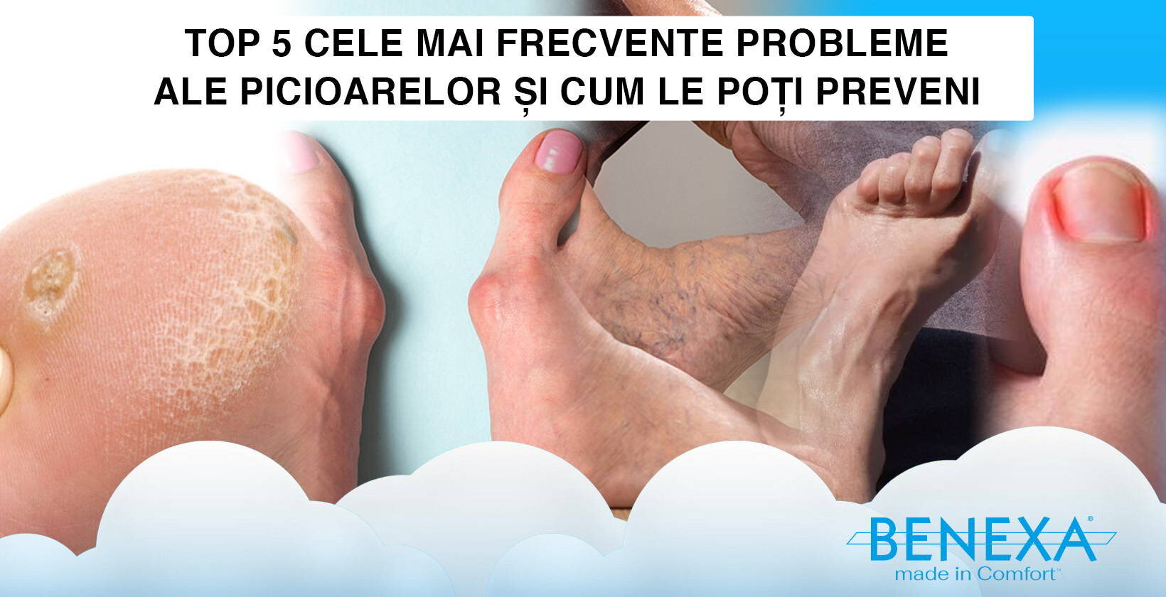 Prevenire: încălțăminte și șosete adecvate