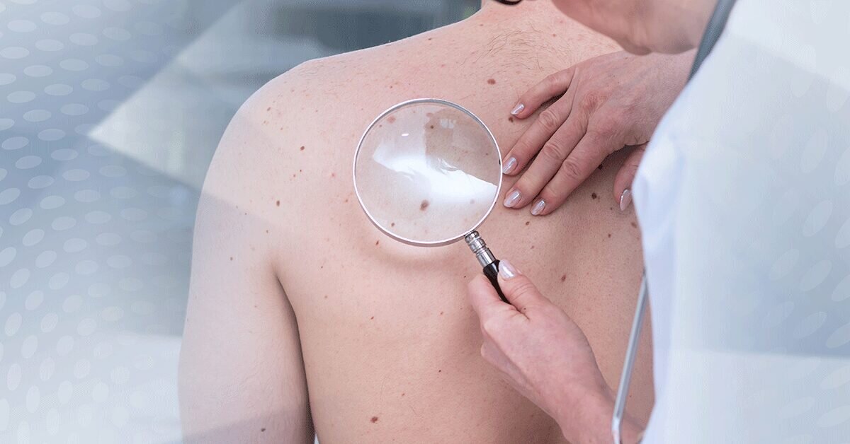 Recomandată de dermatologi pentru vara.