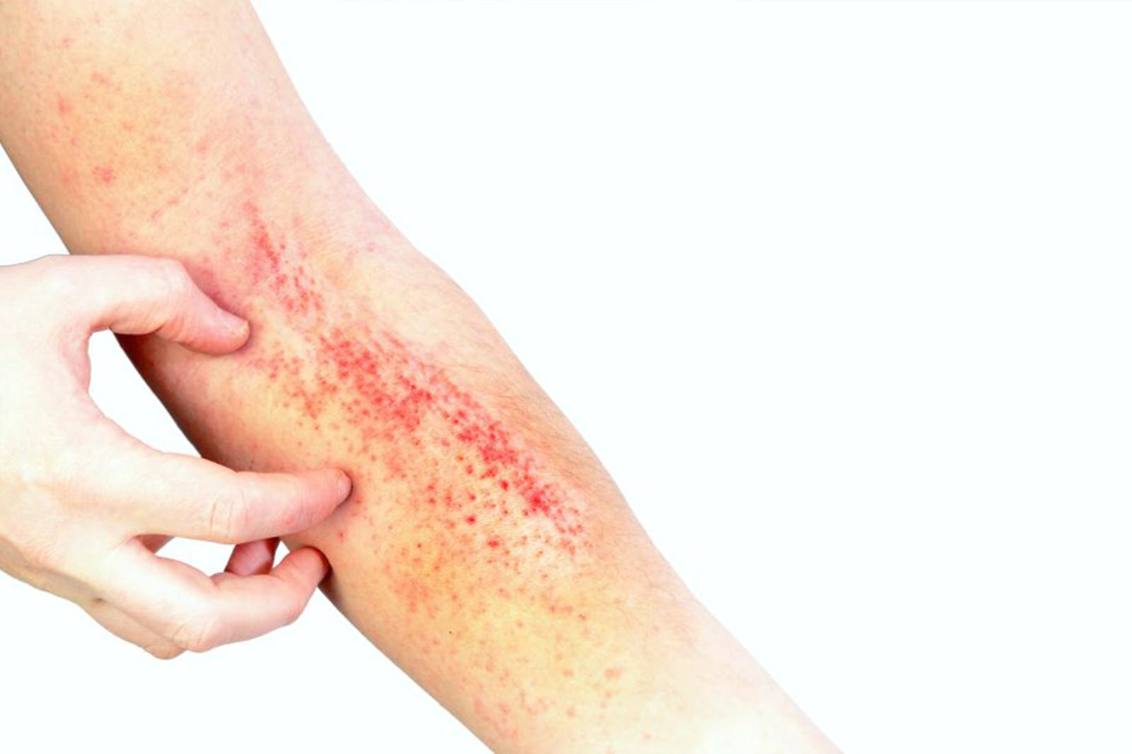 Recomandări dermatologice