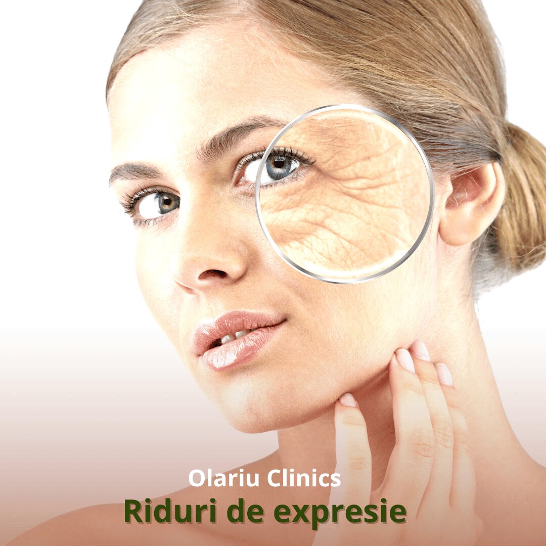 Reducerea ridurilor și liniilor de expresie