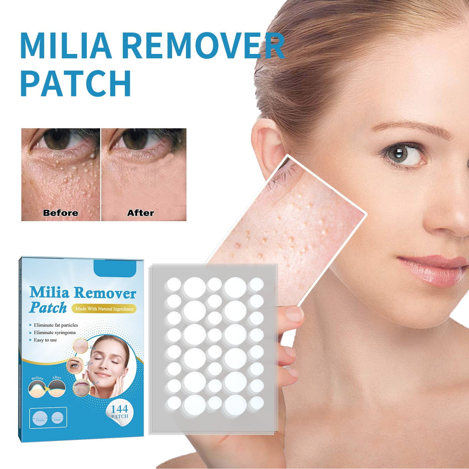 Soluții cosmetice pentru milia