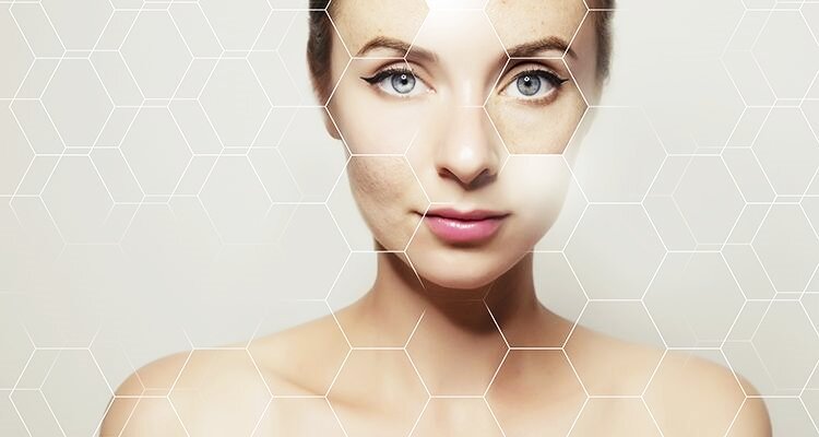 Stimularea producerii de colagen și elastină