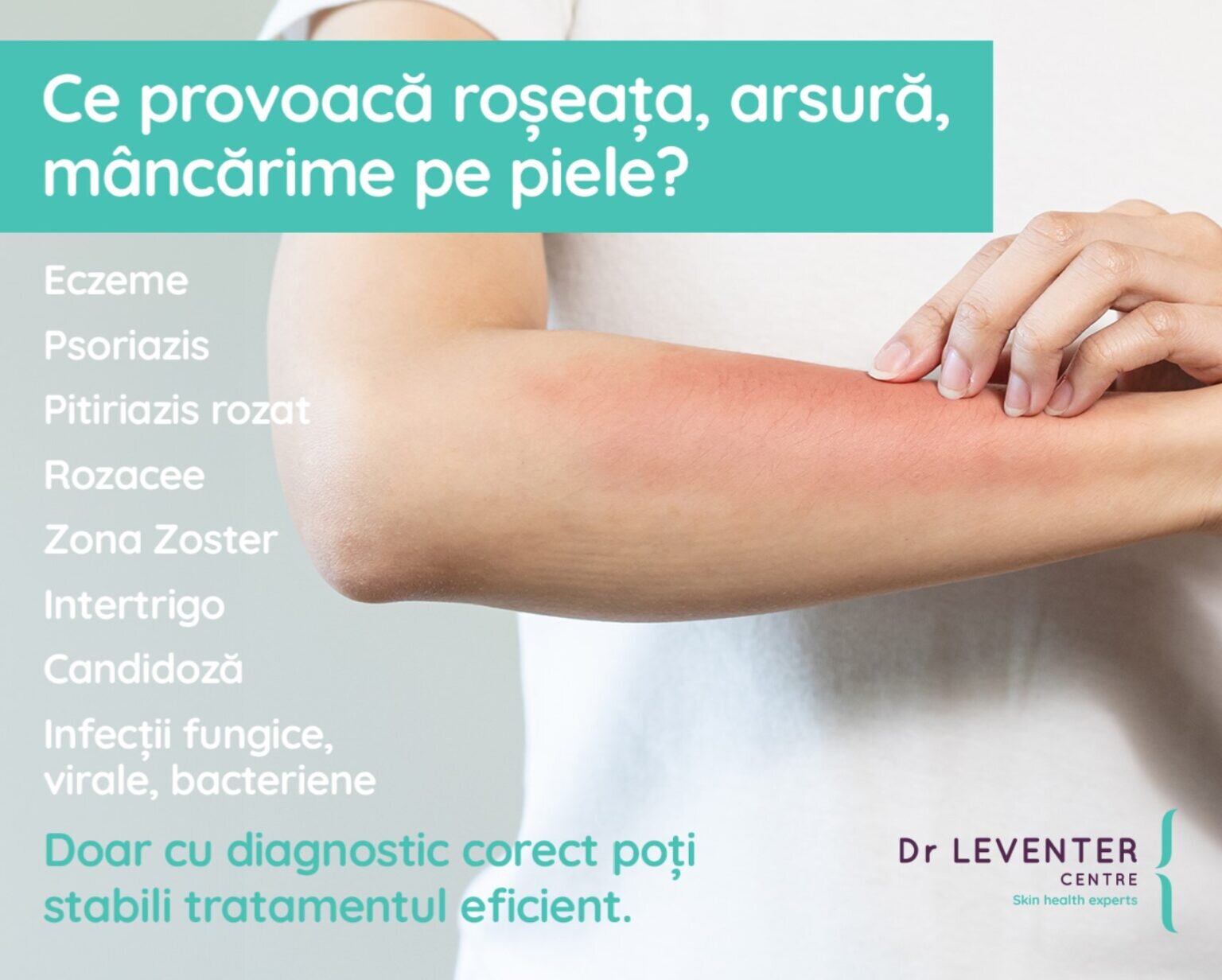 Tratamente pentru diverse probleme ale pielii